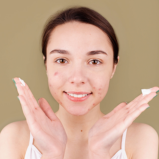 Tratamiento para pieles con acné en Naturaqua
